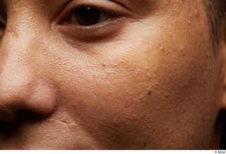 HD Face Skin Elvira Jairo cheek eye face nose scar…